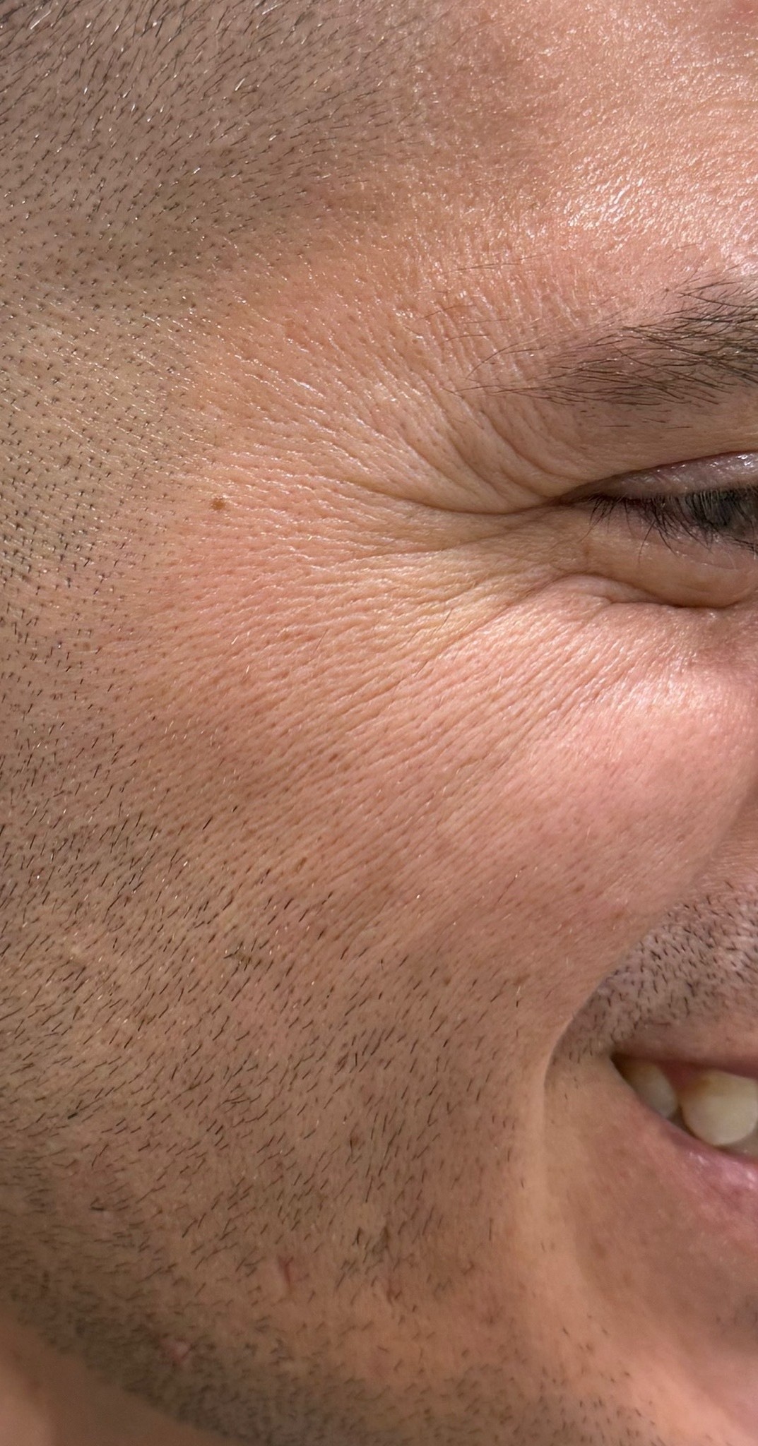 AFTER COLLAGEN SUPPORT